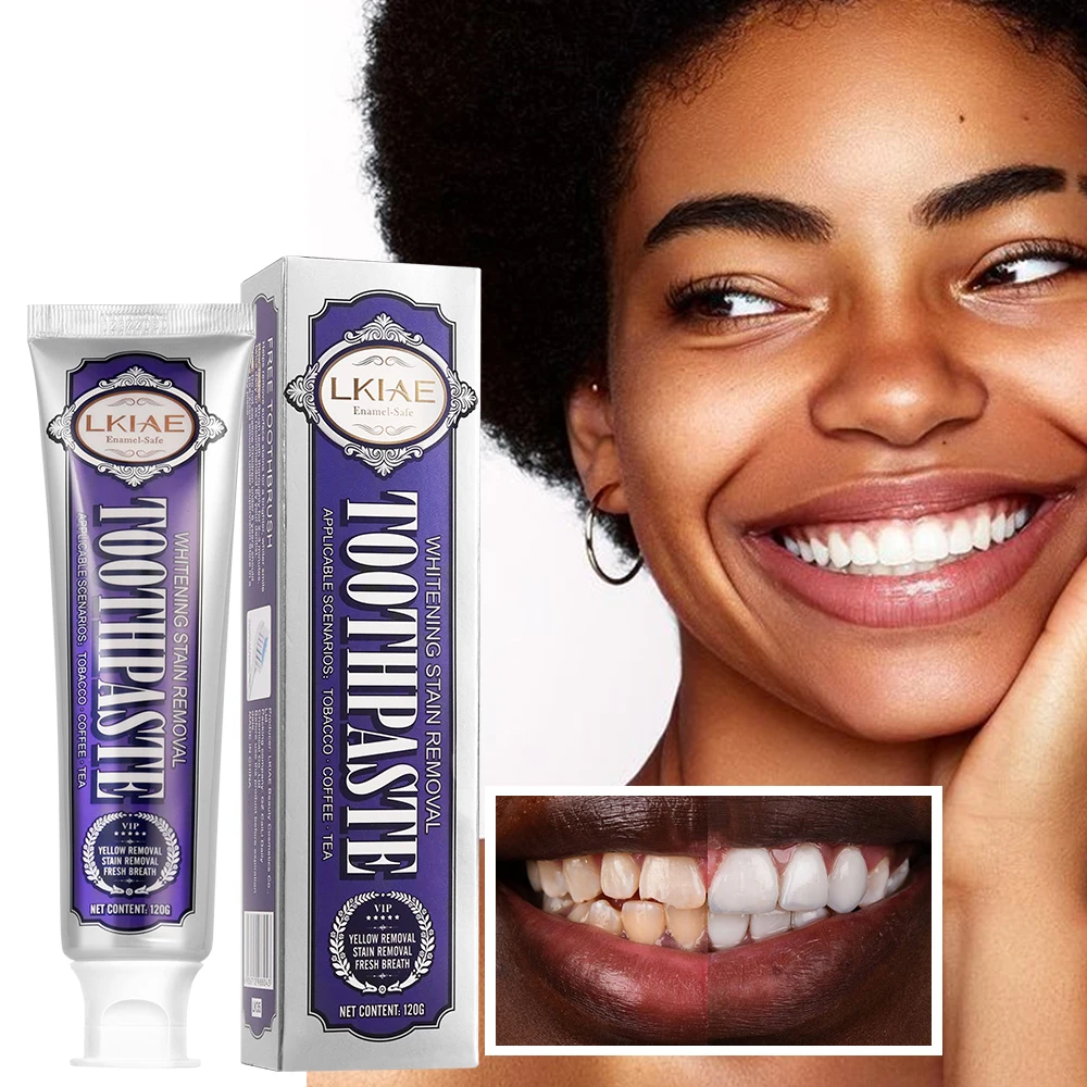 LKIAE White Teeth Whitening Toothpaste, With Natural Mint, Helps Remove Surface Stains For A Brighter, Whiter Smile, 120g