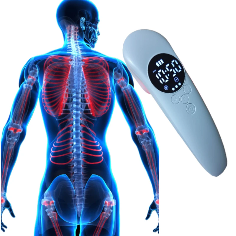 

14x650nm+3x808nm Handheld Laser Therapy Device for Arthritis, Knee Pain, Back Pain, Sciatica, Neuropathy Relief