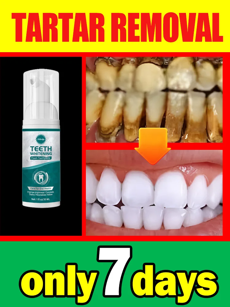 

Teeth Whitening Tartar Removal