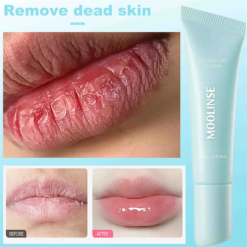 Cooling Peel-Off Lip Mask Firming Reduce Fine Lines Hydrating Anti Drying Cracking Moisturizing Glowing Soothing Lip Balm Care