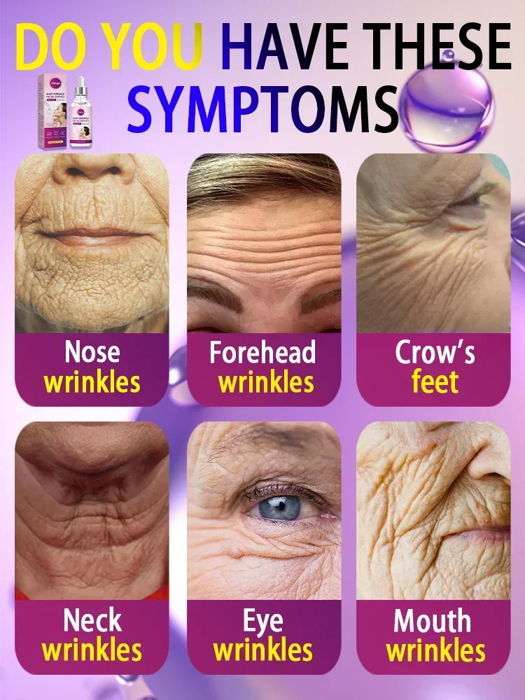 Laser Product To Solves wrinkle troubles