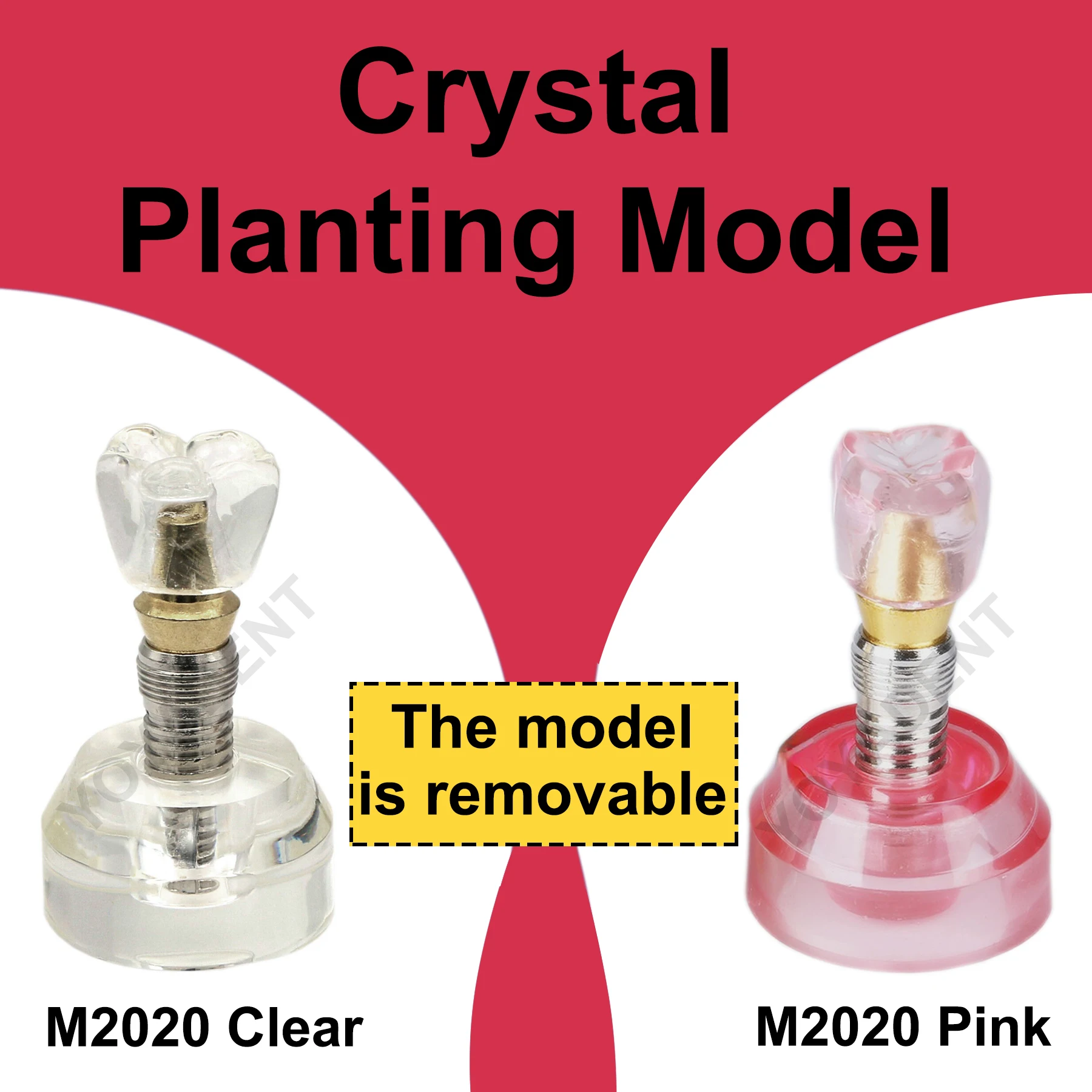 Стоматологическая модель 2,5x размера, модель имплантации зубов, обучающие модели зубов для стоматолога, связь пациента, демонстрационные аксессуары для стоматологии