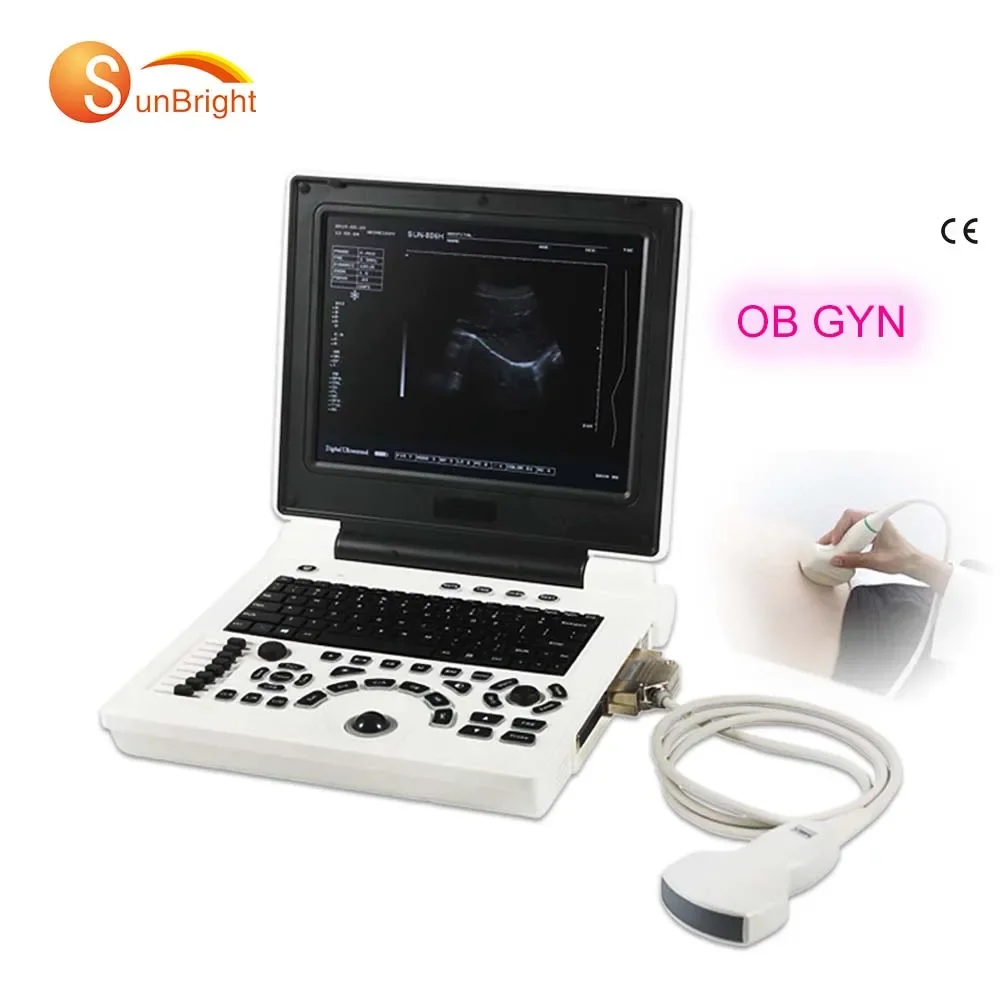 SUN-806H Notebook b ultrasound machine color clear images human pregnancy test ultrasound