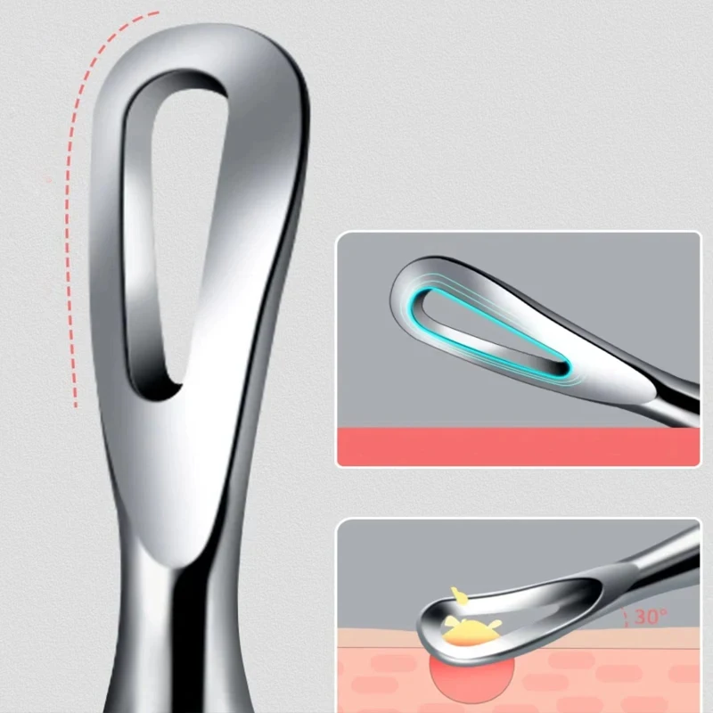 1/2/3 Uds. Pinza alemana ultrafina para espinillas, espinillas, Clip para espinillas, salón de belleza, herramienta especial para eliminar partículas de grasa y acné