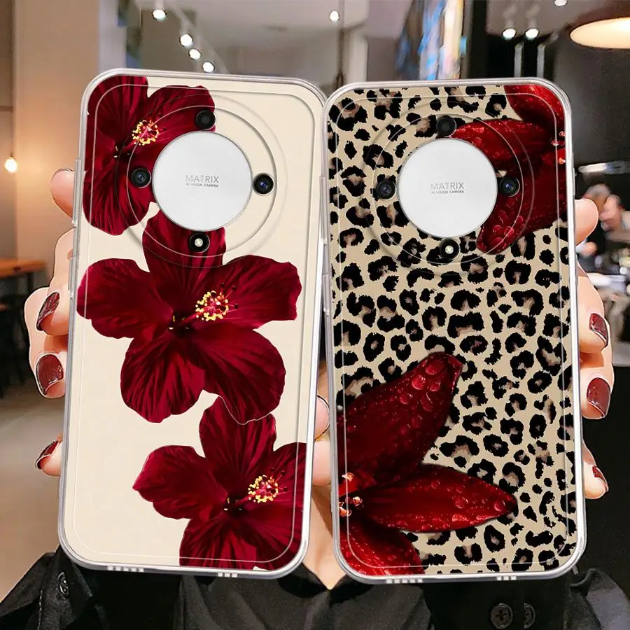 Case for Honor X7b X8b X8 90 Lite X9b X9a X8a Soft Phone Cover Premium Leopard Print