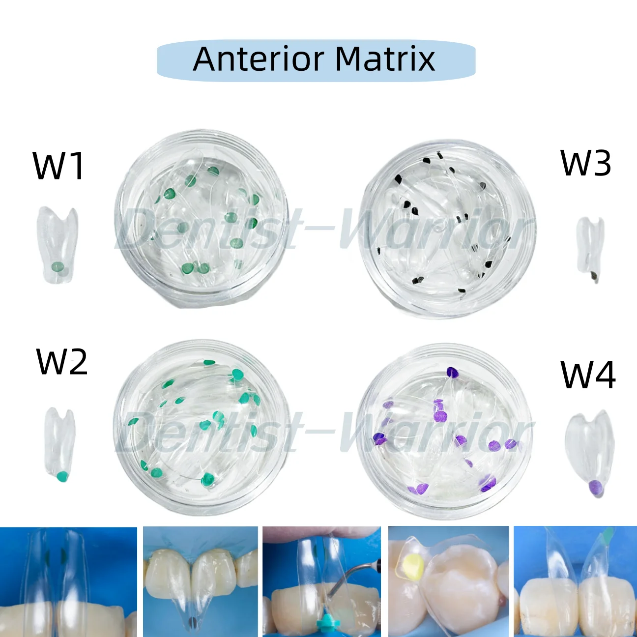 

W1-W4 Dental tranродитель прозрачная матрица, передние широкие восстанавливающие BT лук матрицы Fit BioClear