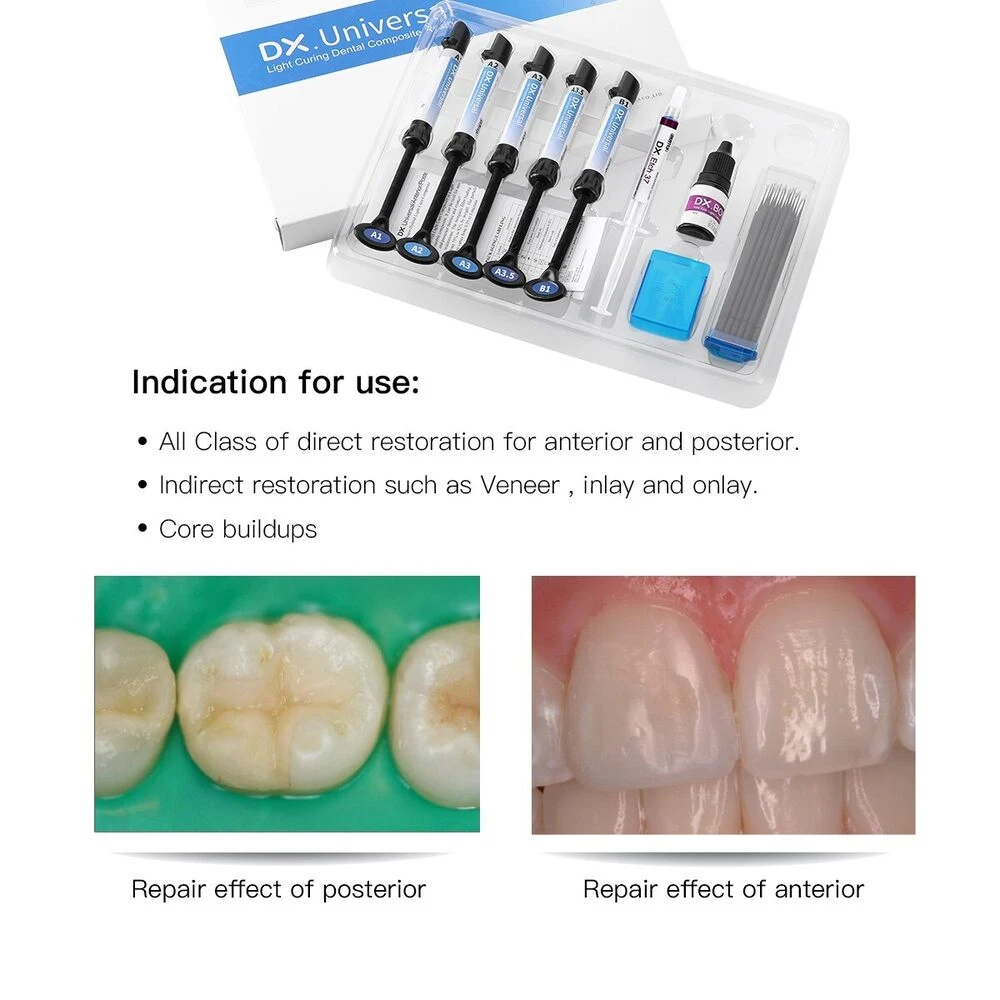 Universal Dental Cura Light Glue, resina composta, colagem adesiva, Etch Gel Kit, suporte ortodôntico, gel de dentes