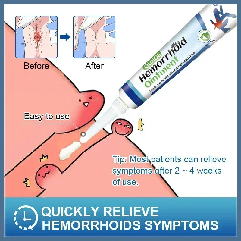 Hua Tuo Powerful Hemorrhoids Ointment Natrual Material Sterilize Cream Internal Hemorrhoids Piles External Fissure Therapy