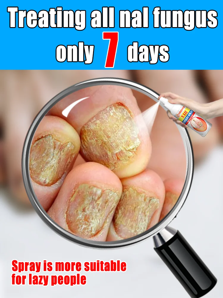 

2025 Toenail Fungus Waterproof Nail Repair, Ingrown Nail Correction, Discolored and Damaged Nails, Foot Care Tools