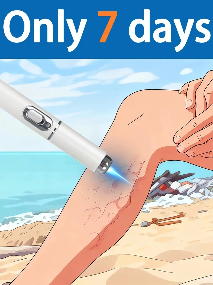 

Blue laser pen Technology changes lives, say goodbye to leg troubles