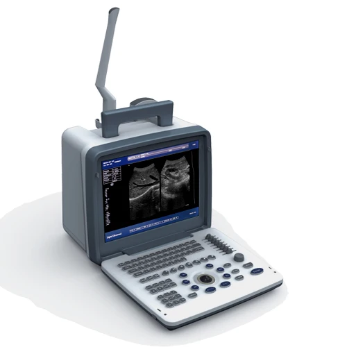 Medical Imaging Equipment Diagnostic Ultrasound System Sonoscape Portable Ob/Gyn Ultrasound Machine For Hospital