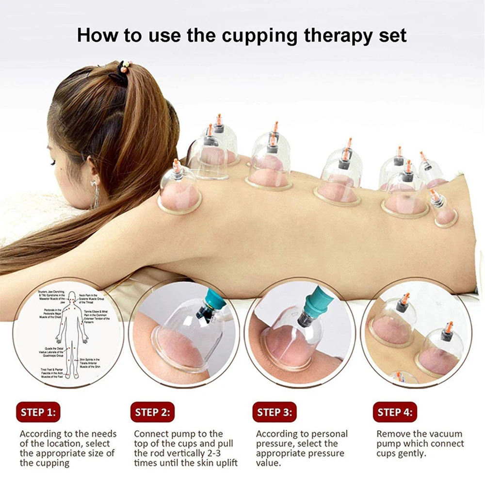 Vacuum Cupping Set Chinese Acupoint Cupping Treatment Set Portable Suction Cup Cupping Set Body Cellulite Cupping Massage Set