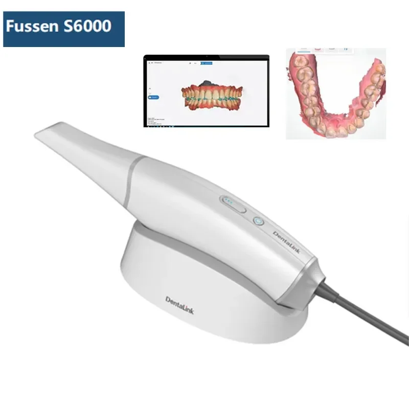 2025/2 Year Warranty Fussen 3D Digital Intraoral Scanner System S6000 X-Rays Scanner Portable Unit Fast Imaging Portable Color