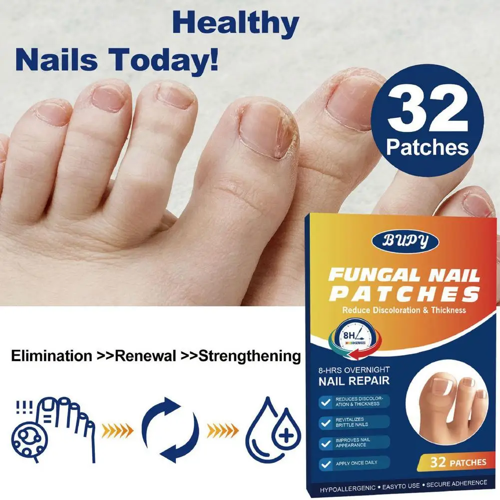 12//3箱 真菌性爪パッチ 爪真菌治療 強力夜間ネイルケア ダメージネイル修復 足ケアツール