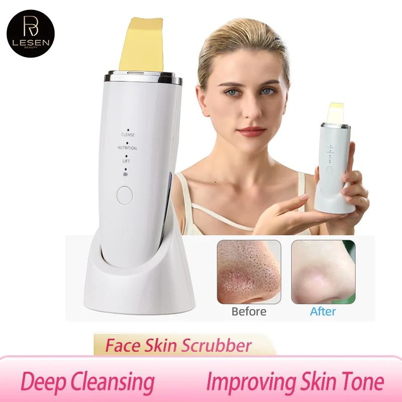 Épurateur de peau à vibrations ultrasoniques, spatule pour le visage, dissolvant de points noirs, pelle, cavitation propre, peeling, lifting du visage, outils de soins de la peau