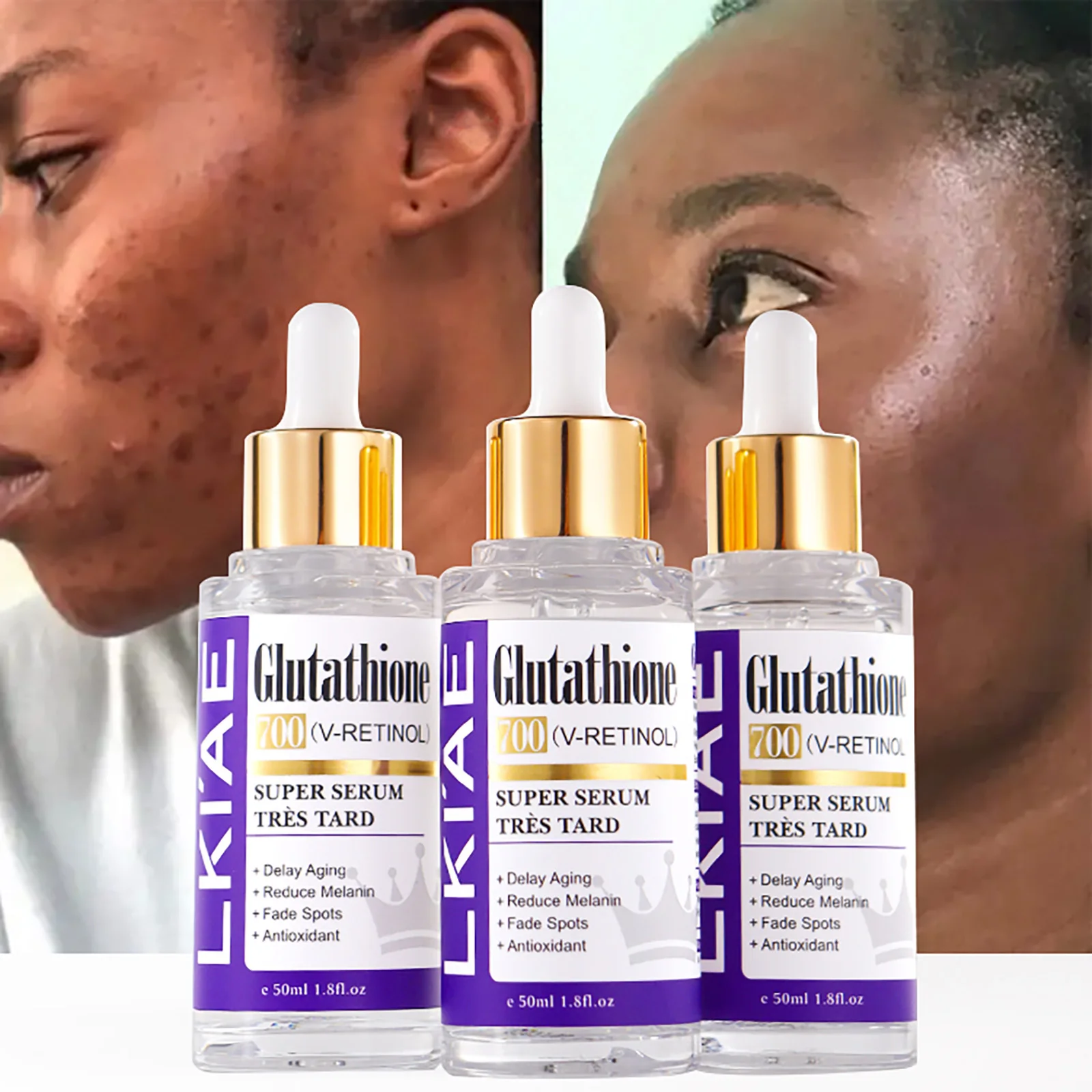 Glutathione Whitening Essence, Reduce Melanin, Black Spots, Anti-Age, With Retinol, For All Skin Types Lightening Facial Serum