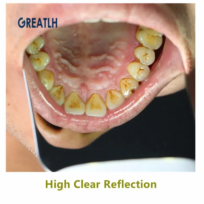 Dental oral photography mirrors Defog occlusal Orthodontic Reflector Glass for Buccal Lingual Intra Oral Dentist Mirrors