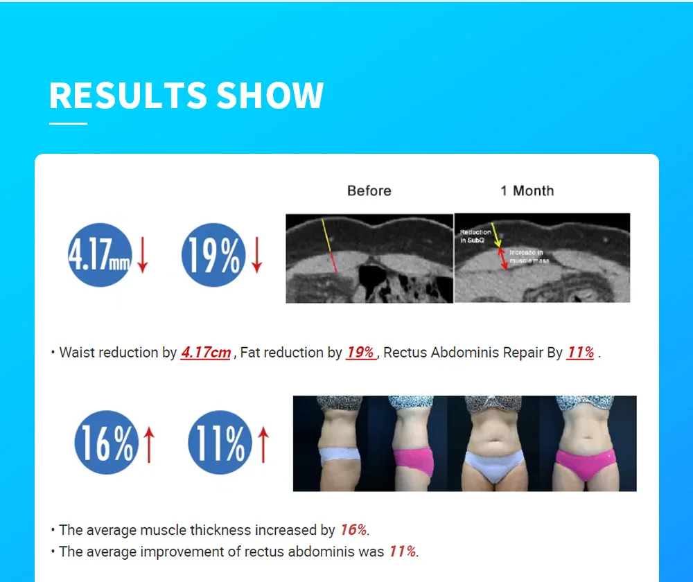 الذكية الجليد الأزرق زائد 7 في 1 الأكسجين هيدرو جلدي فقاعة آلة المهنية الوجه هيدرا آلة rf رفع آلة بالموجات فوق الصوتية #1