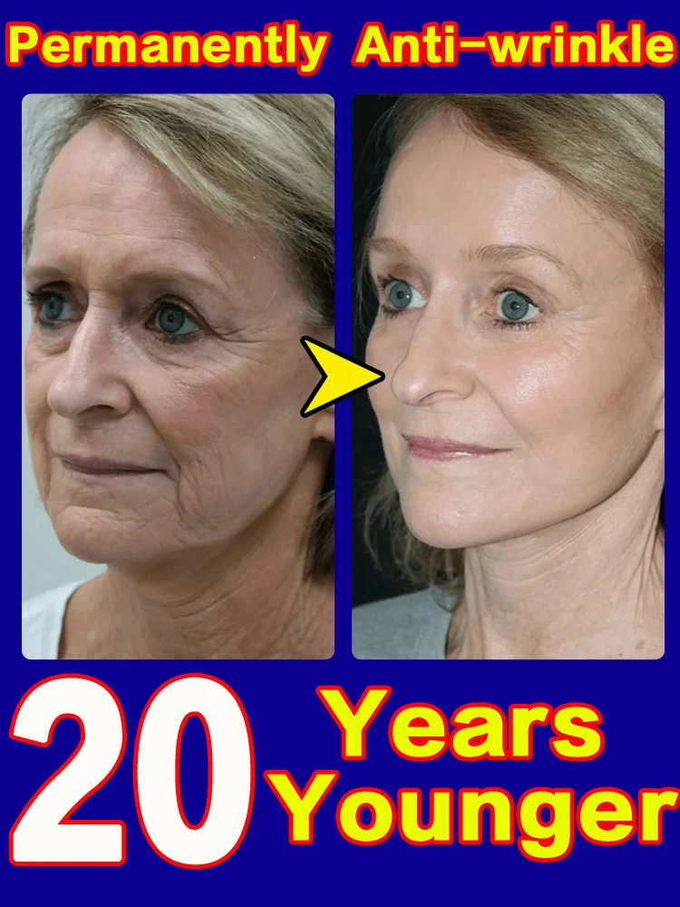 Wrinkle reduce cream face remove nasolabial folds expression lines