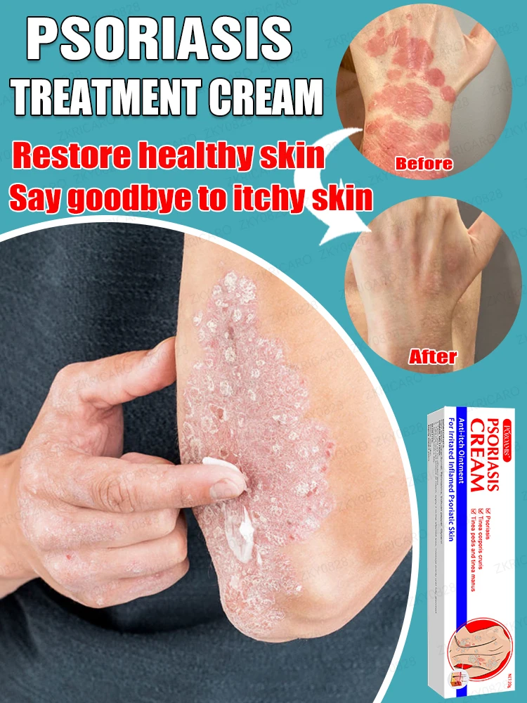 

Have smooth skin and say goodbye to itching.