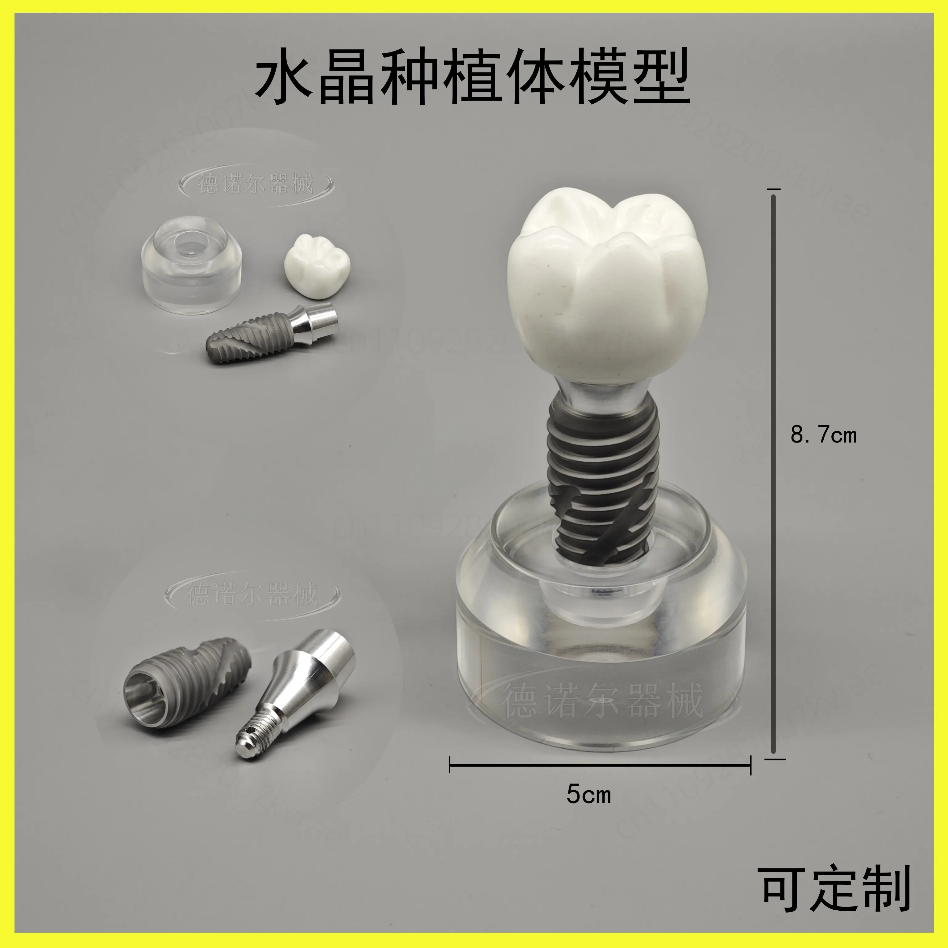 Oral teaching model, implant model, teaching aids, crystal implant model, screw removable model