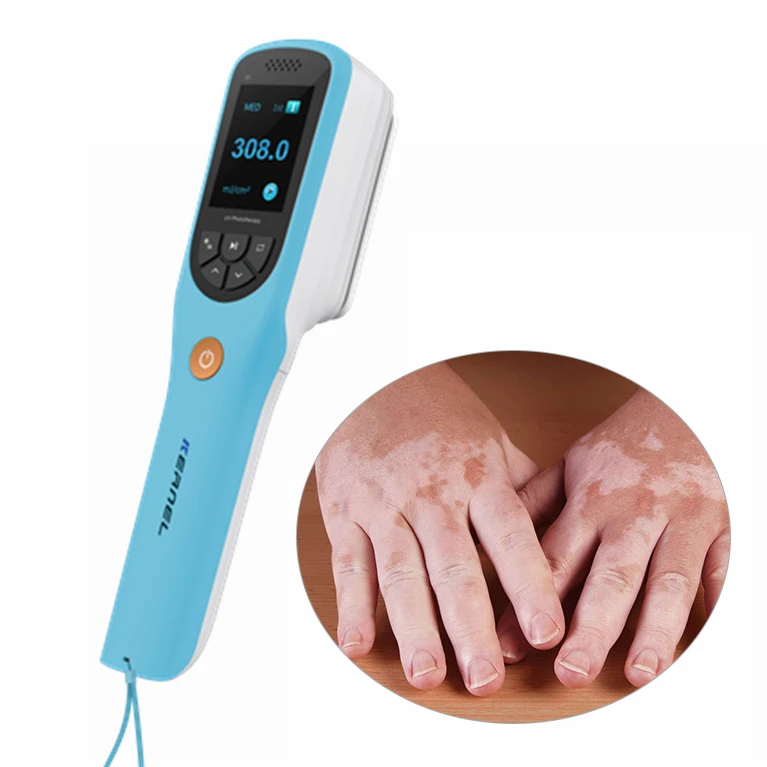 Kernel CN-308B Portable 308nm Excimer Laser psoriasis lamp 308nm LED Vitiligo Cure Treatment Device