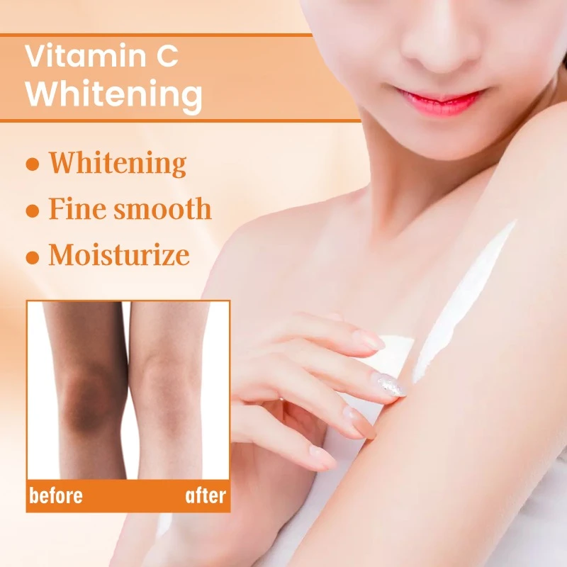 Vitamin C underarm whitening cream elbow knee joint Dark Spot remove melanin inner thigh brighten skin tone improve dullness