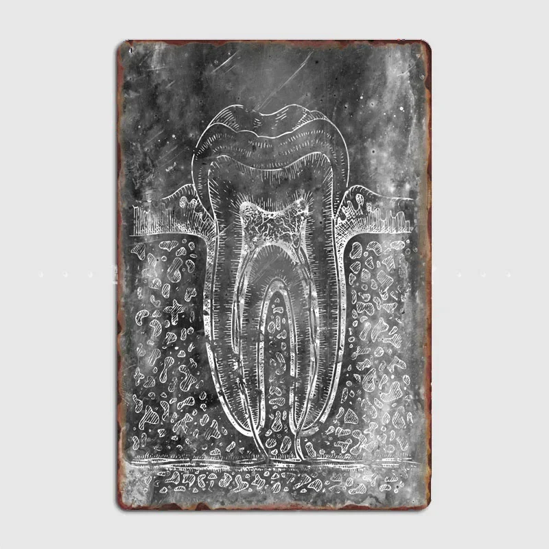 Tooth diagram  wall decor  posters  room decoration  elf bar  metal wall decor  home decor  decorative art