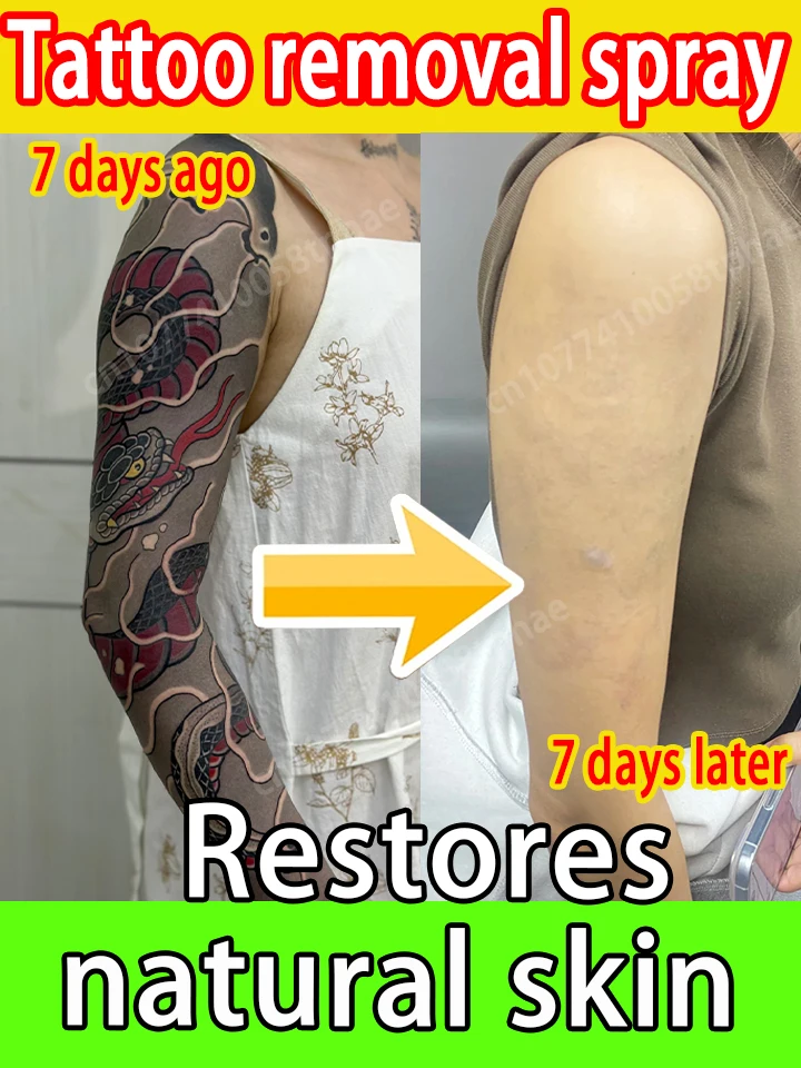 spray-del-tattoo-gentle-morbida-pelle-sottile-fades-senza-seconda-piccolo-e-portabl
