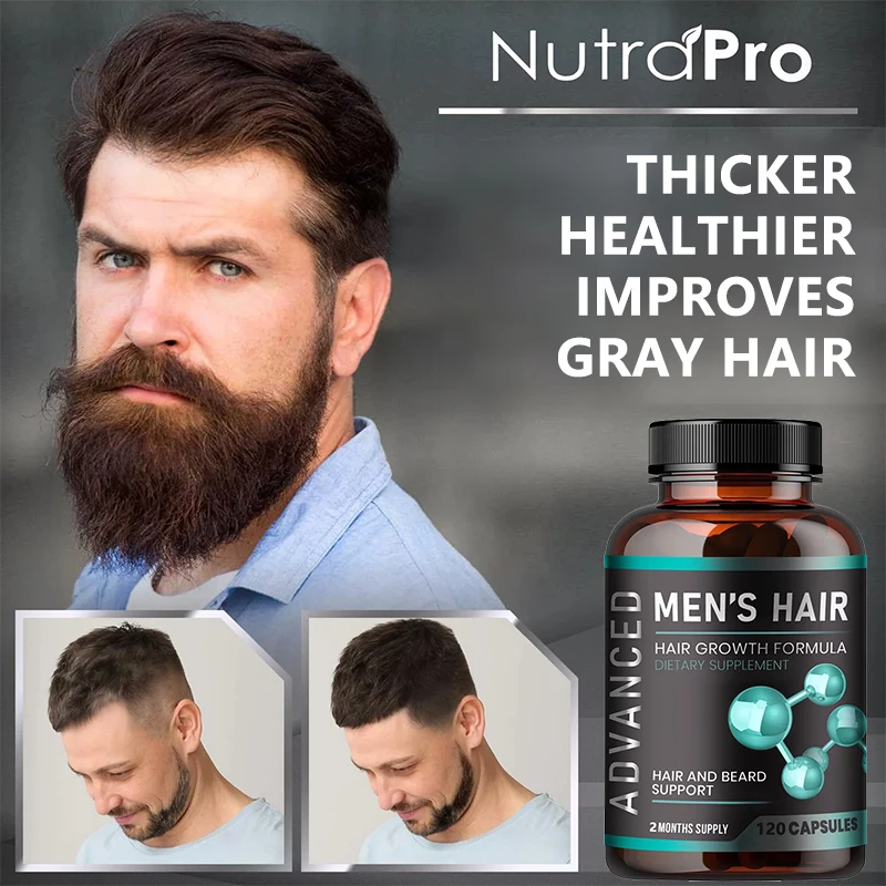 Hair Vitamins for Men - Thick Hair & Beard - Biotin & Saw Palmetto - 120 Capsules