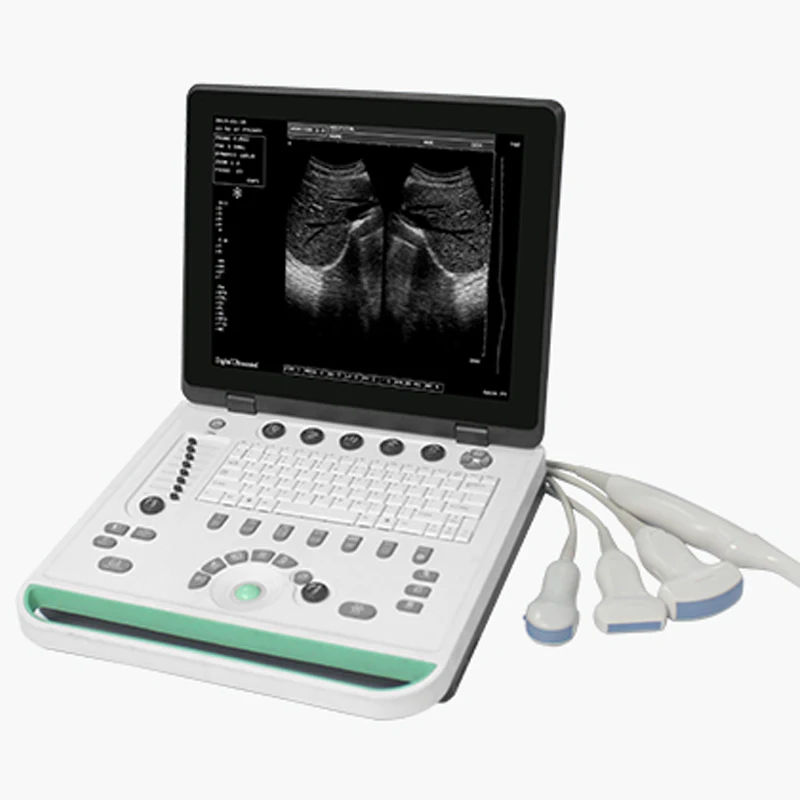 High quality Ultrasound Scanner Machine Human or Veterinary Portable Ultrasound Machine