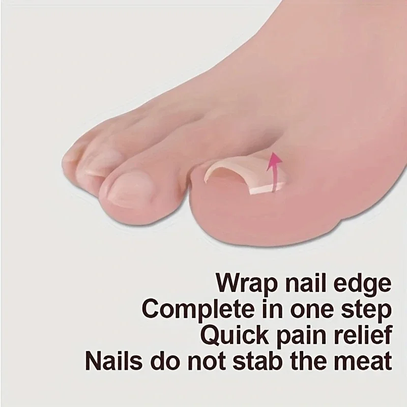 Ingrown Toenail Correction Tool Ingrown Toe Nail Treatment Elastic Patch Sticker Straightening Clip Brace Pedicure Tool