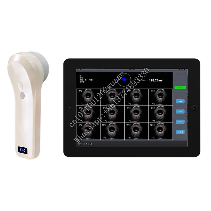 

Medical Equipment 80 Element 4D Wireless Probe Portable Ultrasound Bladder Scanner