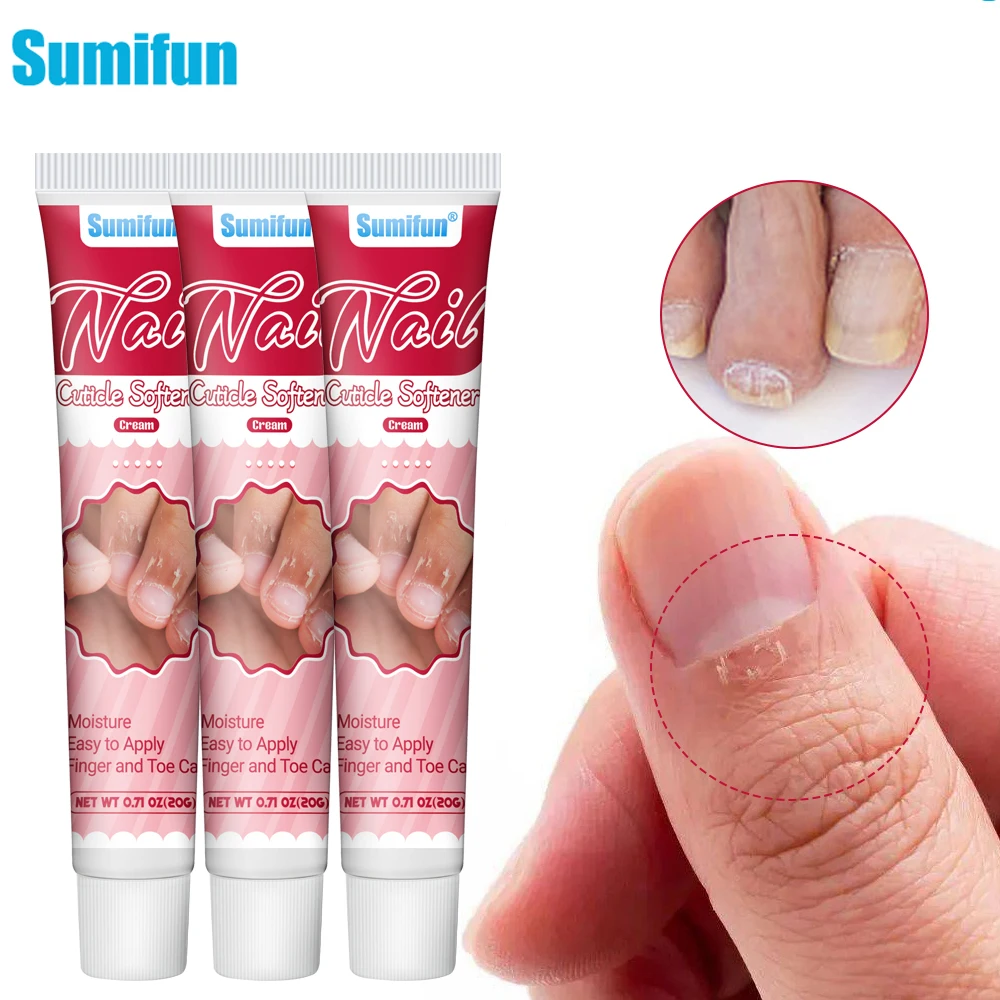 

1/2/3Pcs Sumifun Nail Fungus Cream Remove Paronychia Dead Skin Cuticle Softener Antibacterial Moisturize Nourish Care Plaster