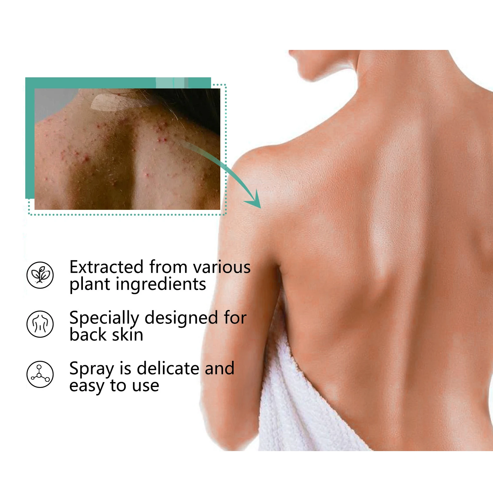 Back Acne Remover Spray Remove Blackhead Oil Control Soothing Redness Deeply Hydration Shrink Pores Body Pimples Removal Spray - view 6