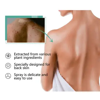 10 best sales Sırt sivilce spreyi - №10