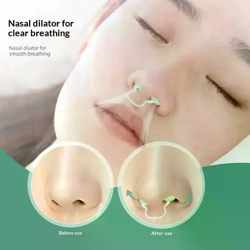 

5/10pcs Disposable U-shaped Nasal Dilator Sponge Nose Clip Breathing Relieve Anti Snoring Nose Soft Health Care