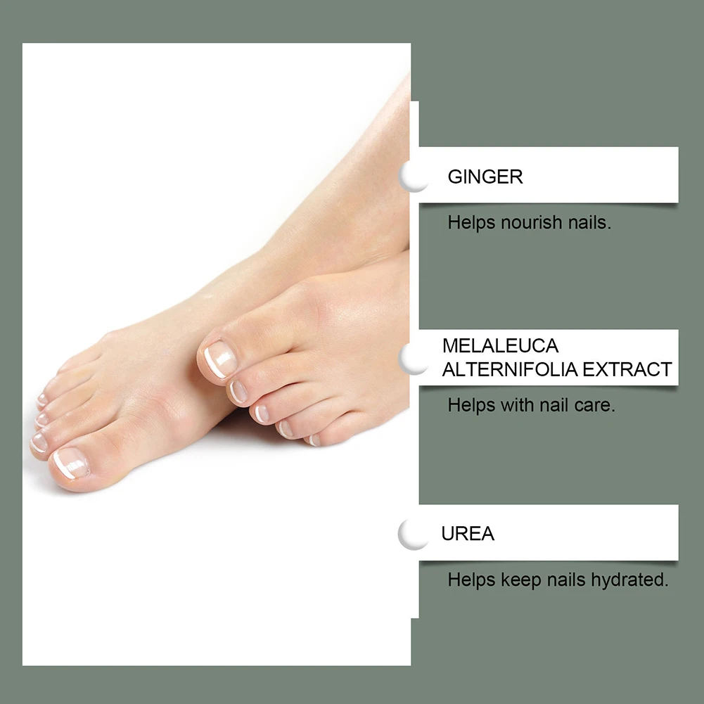 7 วัน Teas Tree Ginger Nailfungus Treatments Nourishing Strengthening Nails Liquid เพื่อการเจริญเติบโตที่ดีต่อสุขภาพ สําหรับผู้ชายผู้หญิง