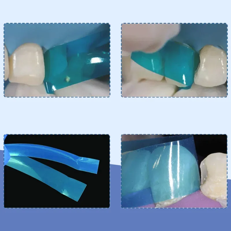 Dental Contoured Anterior Matrix Strip Dentistry Material for Dental Resin Restoration view 5