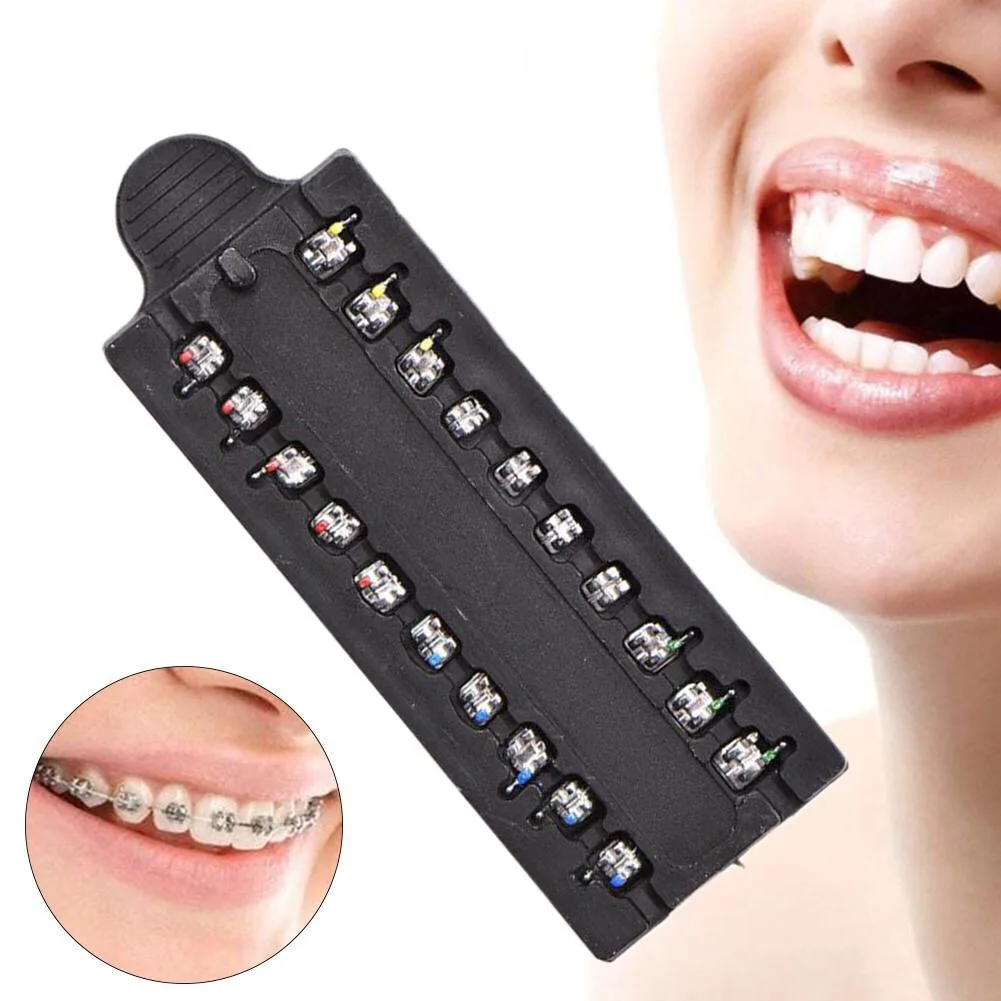 Metal Braces Bracke…