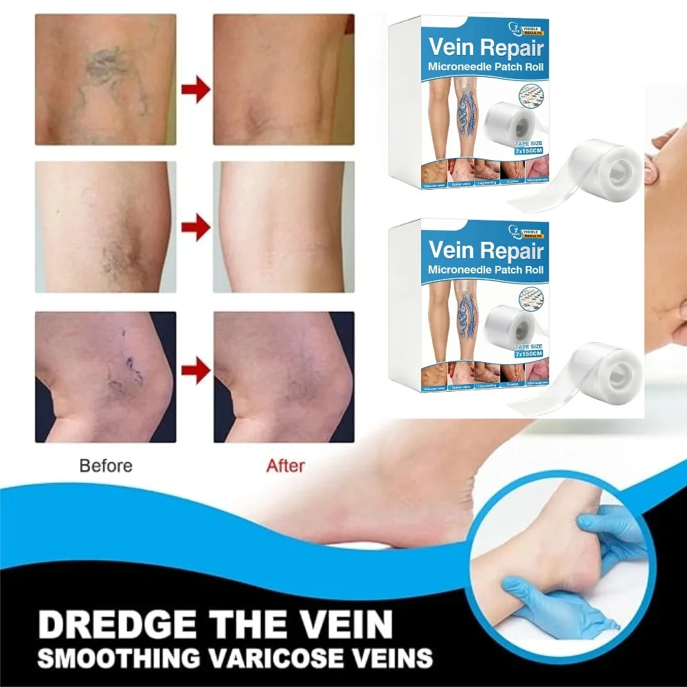 Professional Repair Advanced Vein Needles Patches 1/2pcs Vein Repair Microneedle Patch Roll Care Band-aids To Relieve Leg Pain