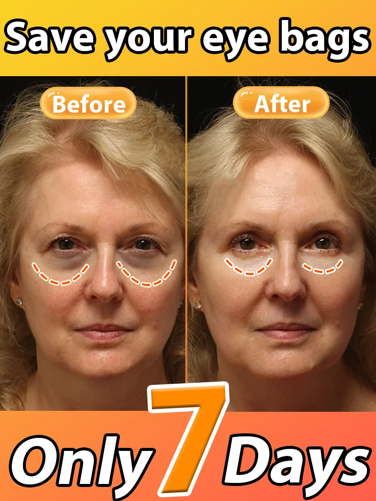 

The best products of 2025,ᴵⁿˢᵗᵃⁿᵗˡʸ ʳᵉᵐᵒᵛᵉ ᵉʸᵉ ᵇᵃᵍˢ⸴ ʳᵉᵈᵘᶜᵉ ᶠⁱⁿᵉ ˡⁱⁿᵉˢ⸴ ᵗⁱᵍʰᵗᵉⁿ ˢᵏⁱⁿ⸴ ᶠⁱᵍʰᵗ ᵈᵃʳᵏ ᶜⁱʳᶜˡᵉˢ⸴ ᵃⁿᵈ ᵇʳⁱᵍʰᵗᵉⁿ ᵉʸᵉˢ