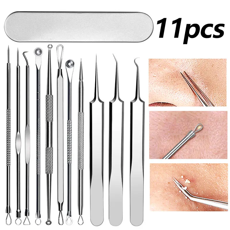 Professional Tweezers Acne Pimples Blackhead Remover Clip Black Dots Blackhead Extractor Acne Needle Facial Cleaning Care Tool