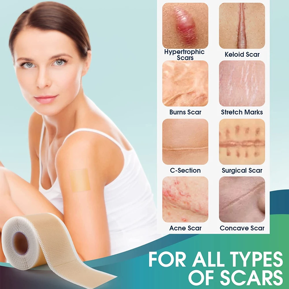 1/2 Professional Silicone Scar Sheets Scars Treatment - Reusable Silicone Scar Strips Type for Keloid,C-Section,Surgery,Acne et