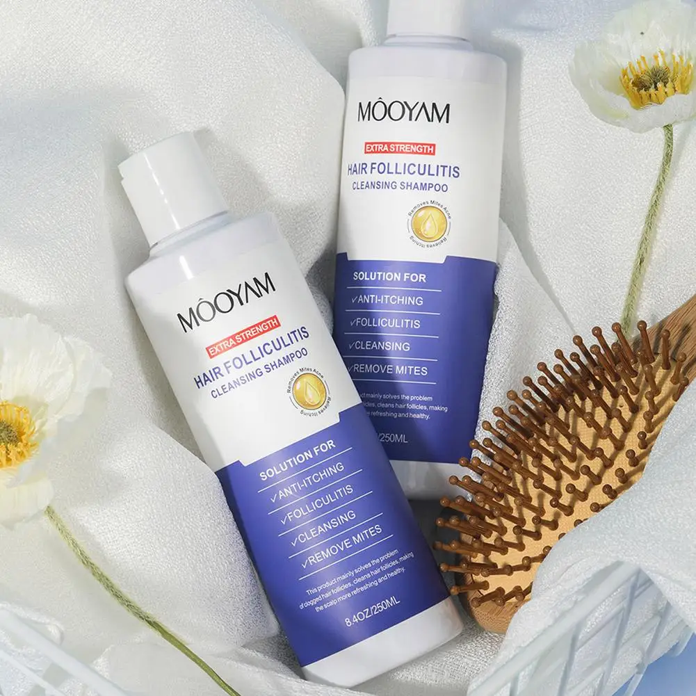 250 مللي شامبو إزالة القمل العث القشرة الحكة النفط تنظيف فروة الرأس الشعر العميق بصيلات مضادة للحكة تنظيف العناية بالشعر