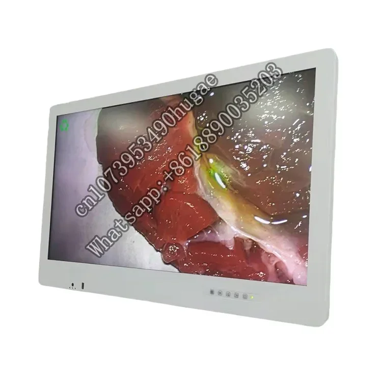 4k 32 inch professional endoscopic medical monitors for laparoscopico