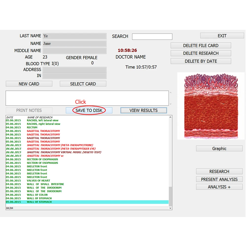 Bioresonance 8d nls therapy analyzer faster and stable chakra aura machine