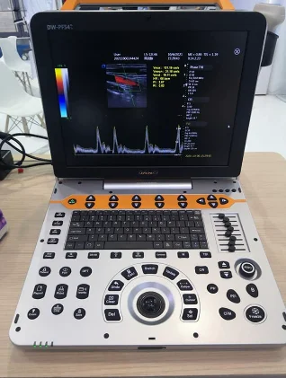 Veterinary Equipment Suppliers Portable Veterinary Ultrasound Dog Pregnancy Scanner