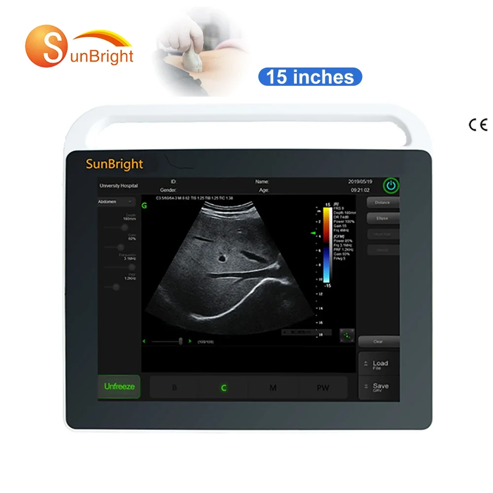 Digital Ecograph Touch Function Laptop Portable Black and White Ultrasound Machine SUN-800S