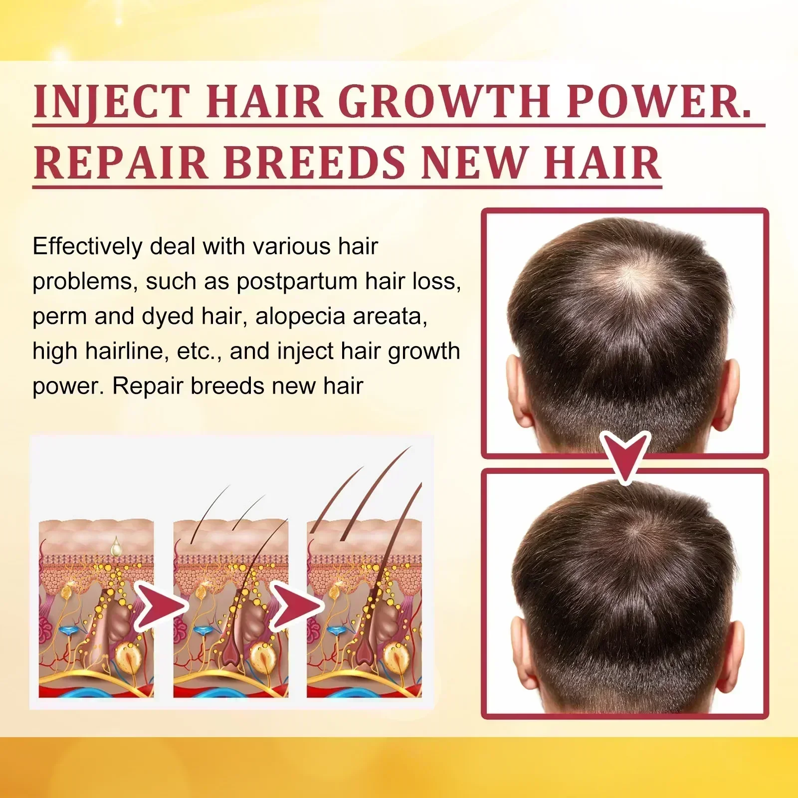 Hot sales Fast Hair Growth Oil Repair Hereditary Hair Loss Postpartum Seborrheic Hair Loss Oil Rapid Growth Care